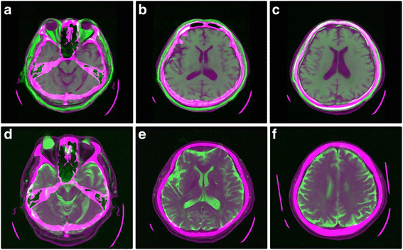 figure 19