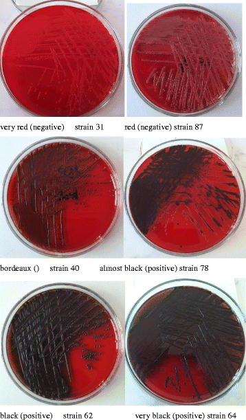 Mysterium Slud aIDS Antibiotic resistance, ability to form biofilm and susceptibility to copper  alloys of selected staphylococcal strains isolated from touch surfaces in  Polish hospital wards | Antimicrobial Resistance & Infection Control | Full  Text