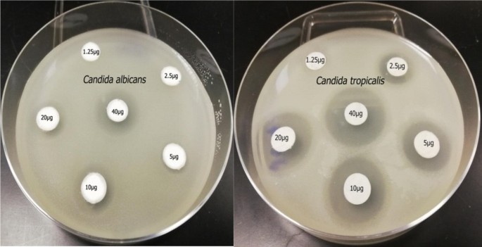 In vitro antifungal resistance profile of Candida strains isolated from  Saudi women suffering from vulvovaginitis | European Journal of Medical  Research | Full Text