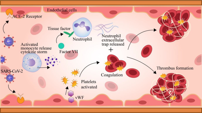 Neurological manifestations of SARS-CoV-2: complexity, mechanism 