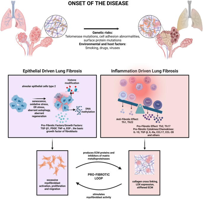 Insight into the pathogenesis of interstitial lung diseases and near-to ...