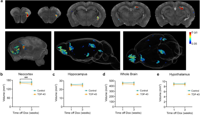 Hippocampus Nº 43