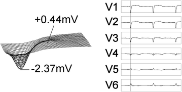 figure 8