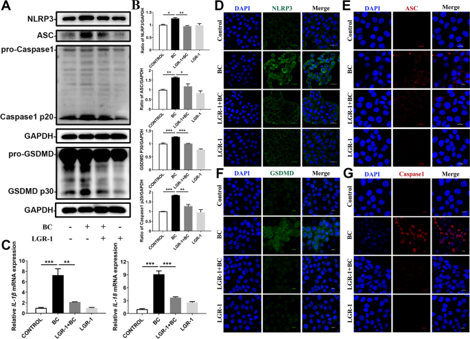 Lacticaseibacillus rhamnosus GR-1, a.k.a. Lactobacillus rhamnosus GR-1:  Past and Future Perspectives: Trends in Microbiology