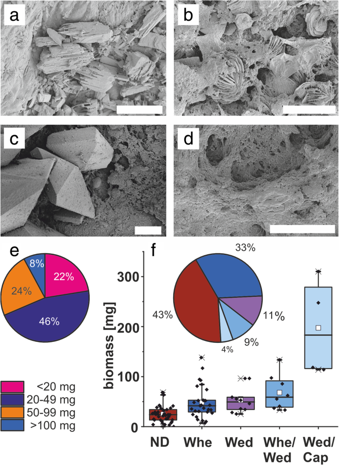 Encrustations On Ureteral Stents From Patients Without Urinary Tract Infection Reveal Distinct Urotypes And A Low Bacterial Load Microbiome Full Text