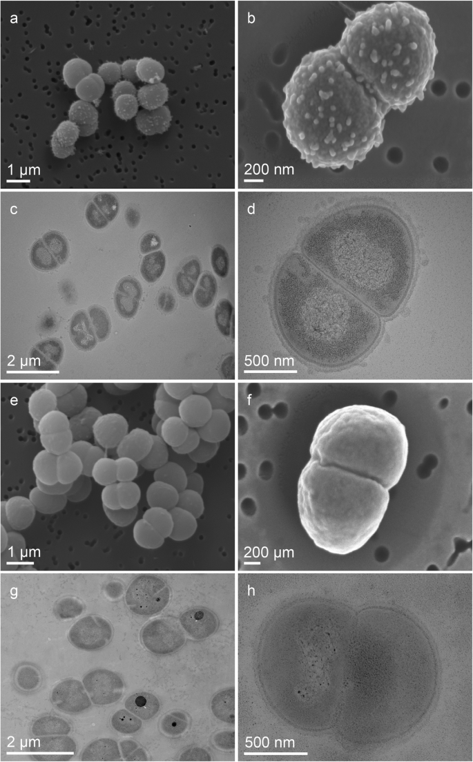 Deinococcus Radiodurans Art Radiotrophic Bacteria Print 