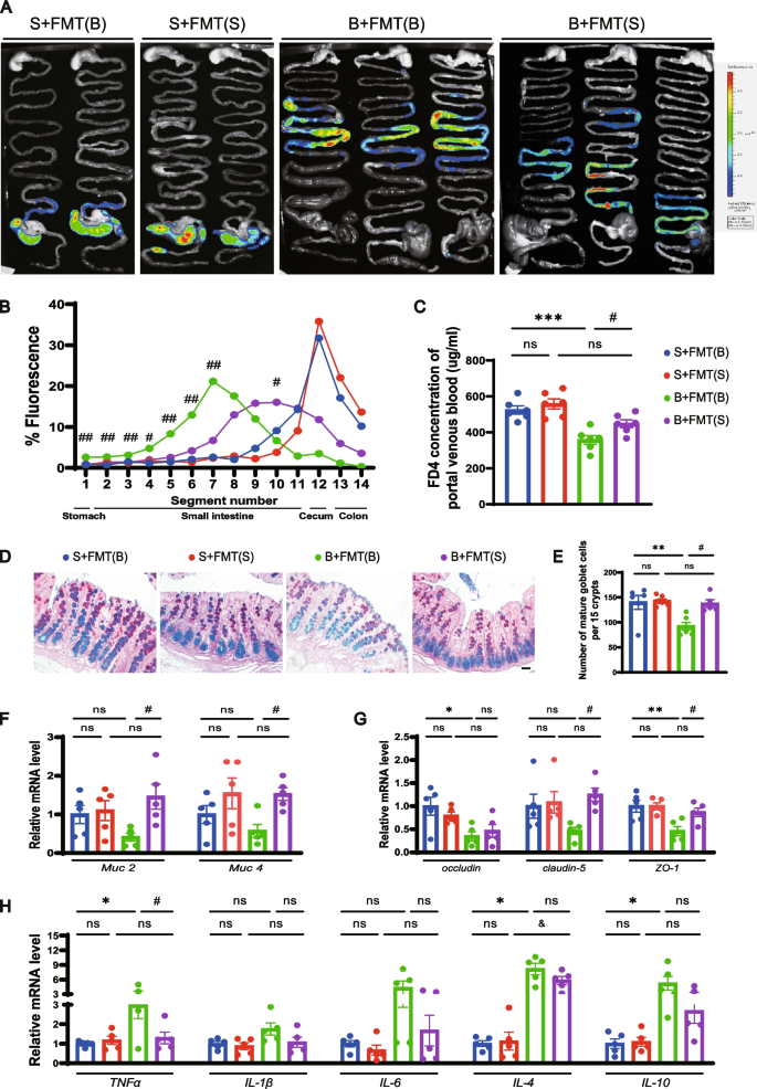 The microbiota-gut-brain axis participates in chronic cerebral  hypoperfusion by disrupting the metabolism of short-chain fatty acids |  Microbiome | Full Text