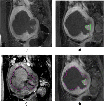 figure 105