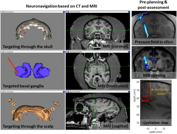 figure 38