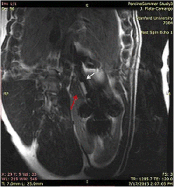 figure 144