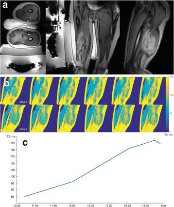 figure 170