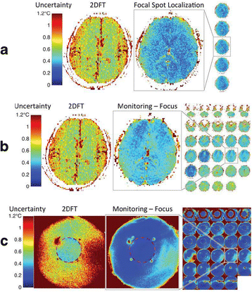 figure 31