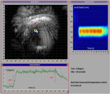 figure 135