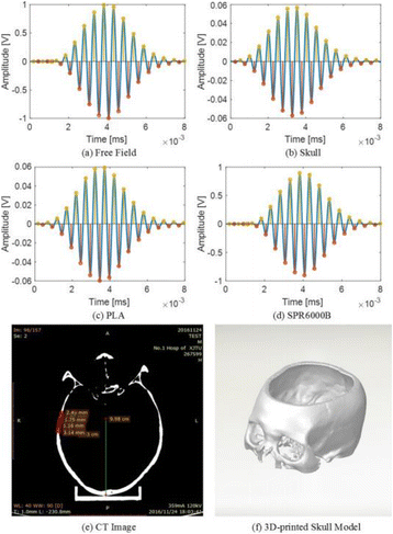 figure 175