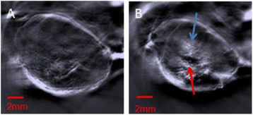 figure 33