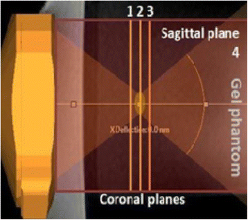 figure 65