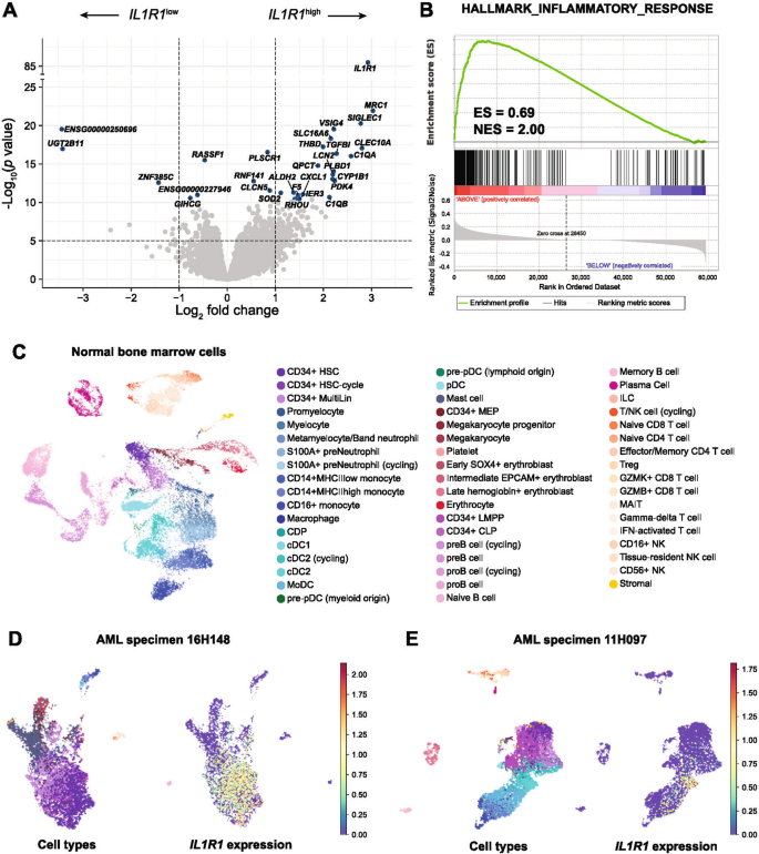 High IL1R1 expression predicts poor survival and benefit from stem cell ...