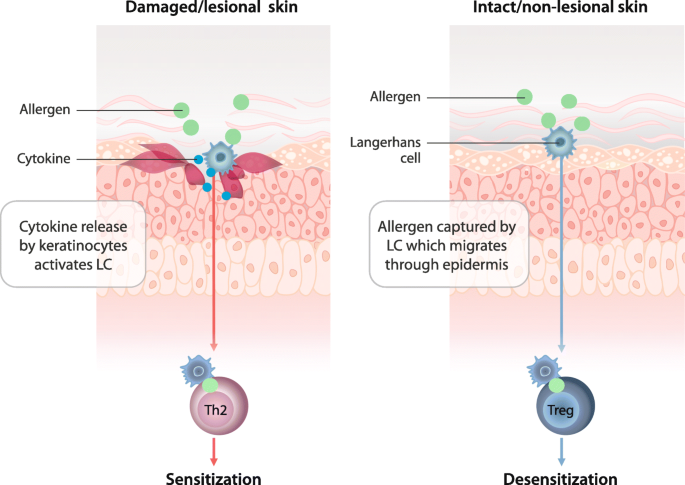 Skin as an immune organ and clinical applications of skin-based  immunotherapy | World Allergy Organization Journal | Full Text