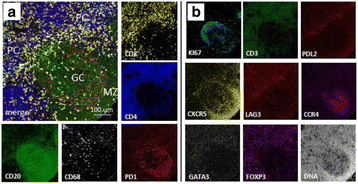 figure 31