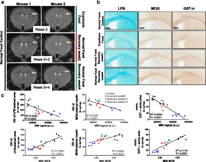 Brain Region Specific Enhancement Of Remyelination And Prevention Of Demyelination By The Csf1r Kinase Inhibitor Blz945 Acta Neuropathologica Communications Full Text