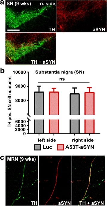 phosphorylated asyn stereology phosphorylated asyn stereology