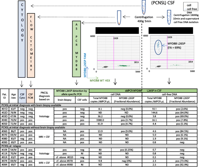 Tumor Cell Free Dna Detection In Csf For Primary Cns Lymphoma Diagnosis Acta Neuropathologica Communications Full Text