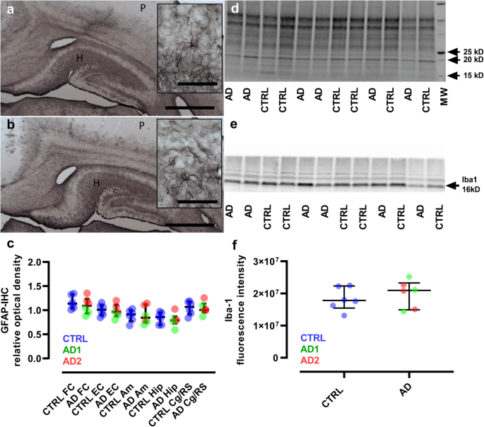 Encephalopathy Induced By Alzheimer Brain Inoculation In A Non Human Primate Acta Neuropathologica Communications Full Text