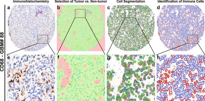 Immune landscapes associated with different glioblastoma molecular subtypes