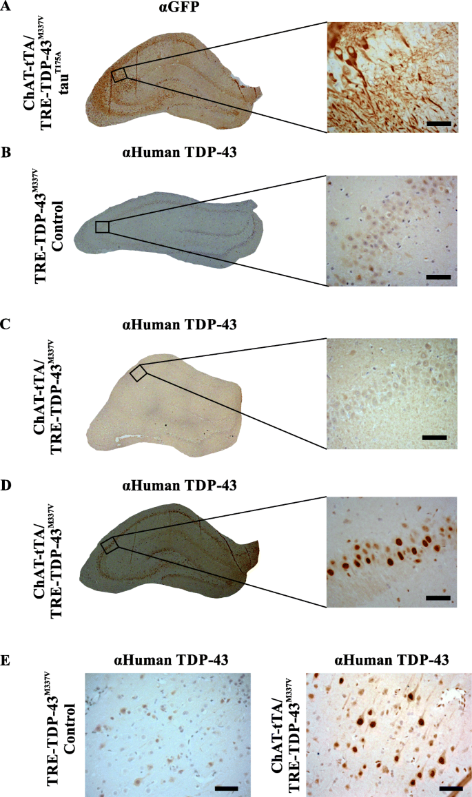 Synergistic Toxicity In An In Vivo Model Of Neurodegeneration Through The Co Expression Of Human Tdp 43 M337v And Tau T175d Protein Acta Neuropathologica Communications Full Text