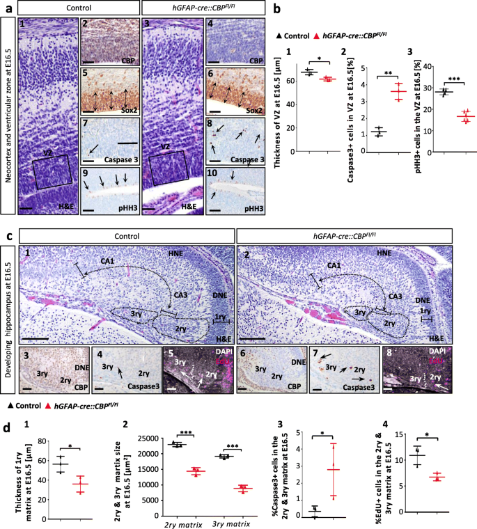 Microdeletions and mutations of CREBBP (CBP) gene can cause