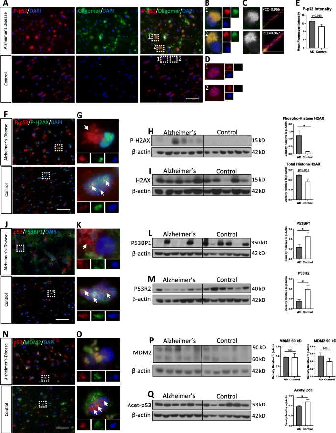 p53 aggregation interactions with tau