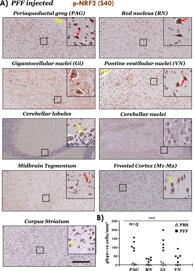 phosphorylated asyn stereology phosphorylated asyn stereology