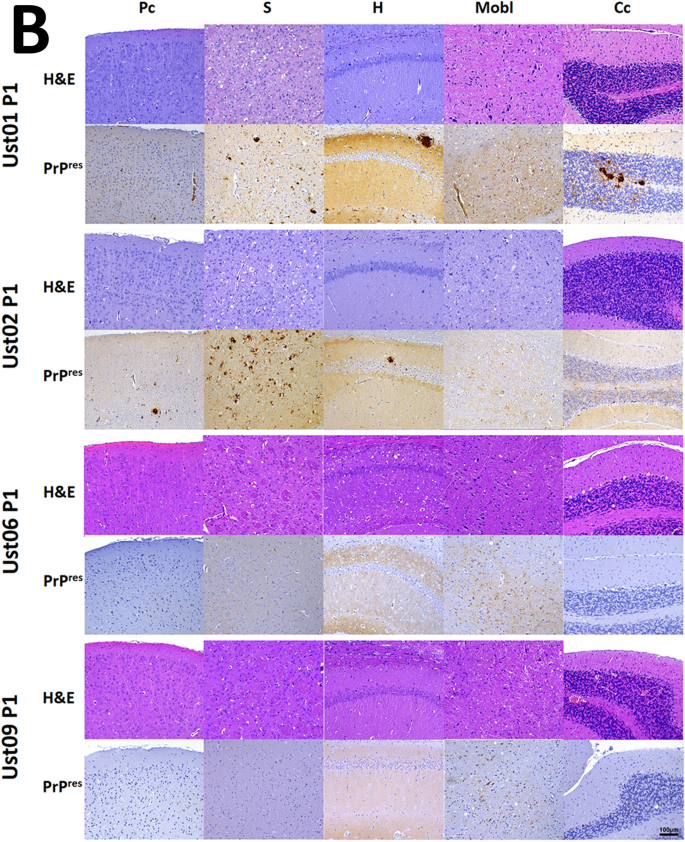 Detection of Prions in a Cadaver for Anatomical Practice