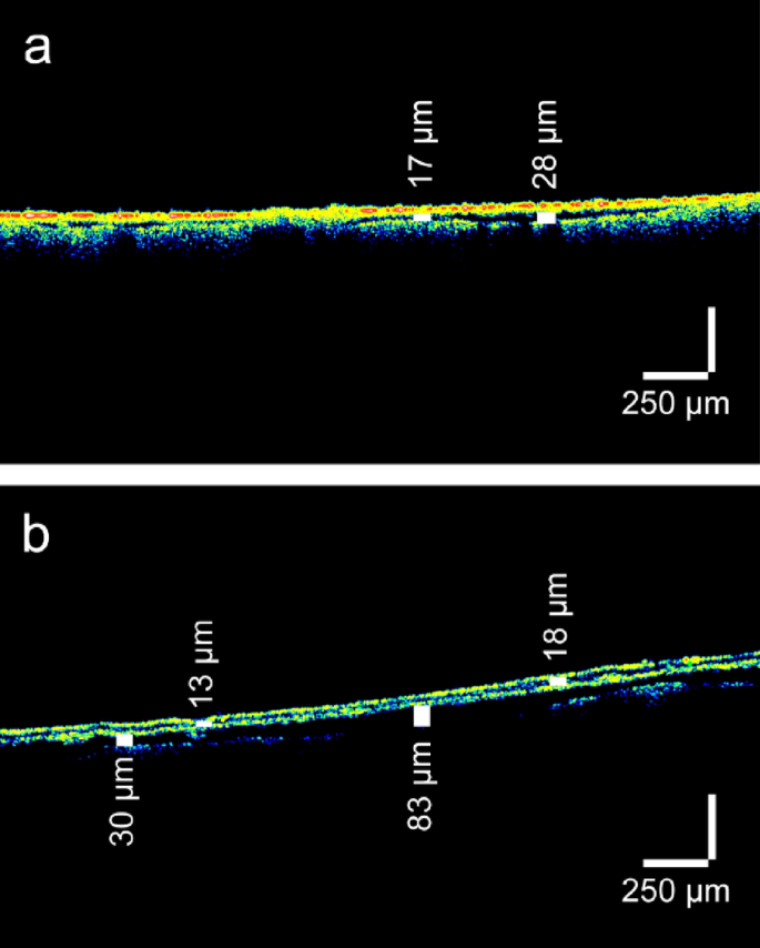 figure 11