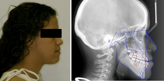 dolphin imaging consultants oral surgery dolphin imaging consultants oral surgery