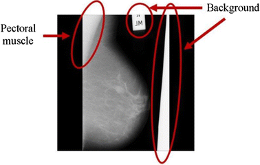 figure 41