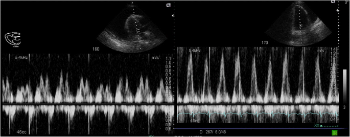 figure 21