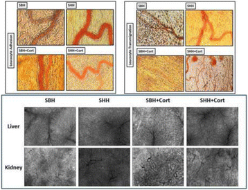 figure 142