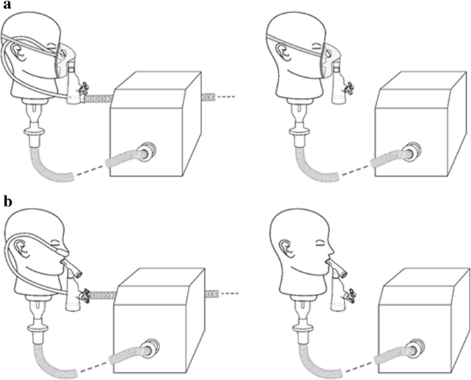 Comparison of aerosol delivery across combinations of drug delivery  interfaces with and without concurrent high-flow nasal therapy | Intensive  Care Medicine Experimental | Full Text