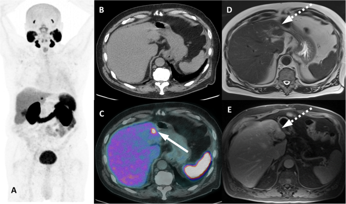 figure 16