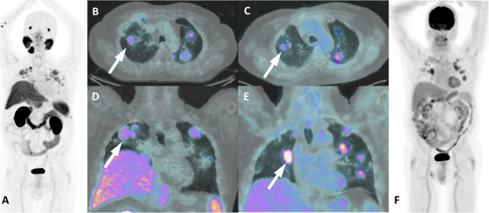 figure 25