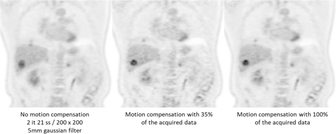 What Scans We Will Read Imaging Instrumentation Trends In Clinical Oncology Cancer Imaging Full Text