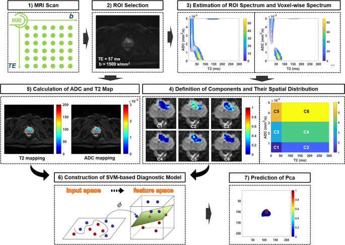 Detection of prostate cancer using diffusion-relaxation correlation spectrum  imaging with support vector machine model – a feasibility study | Cancer  Imaging | Full Text