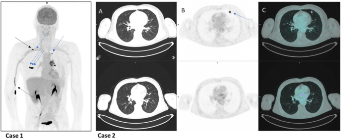 hypothesis in case control study figure 2
