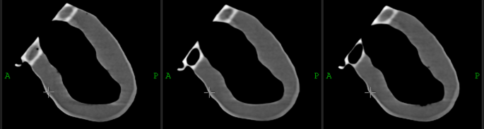 phantom torso figure 6