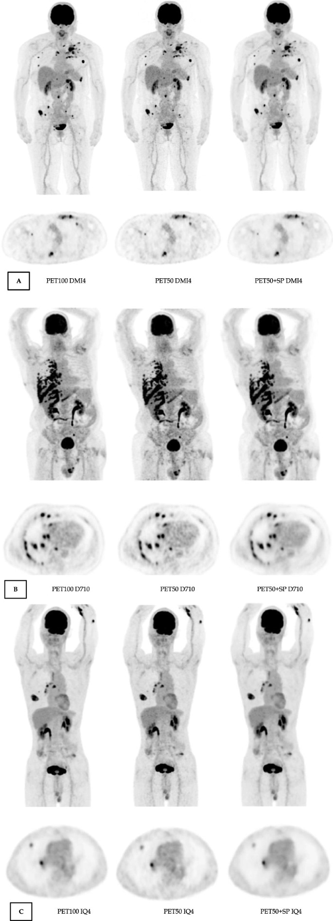 SubtlePET 2.0 Gets CE Mark • APPLIED RADIOLOGY