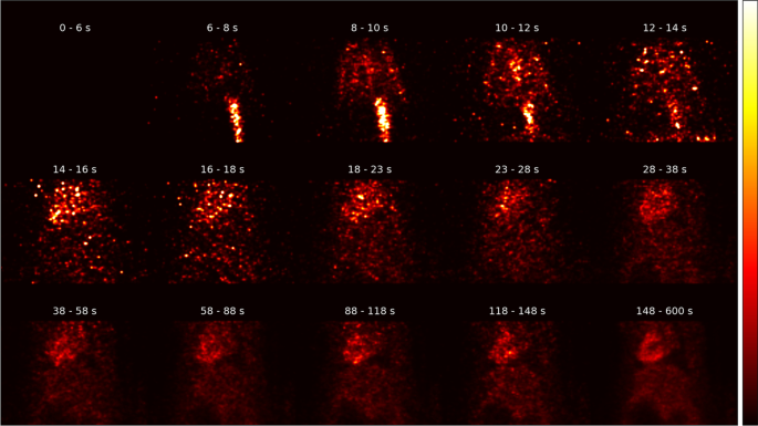 figure 15