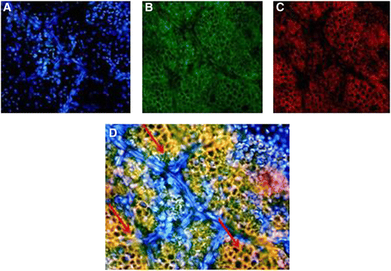 figure 14