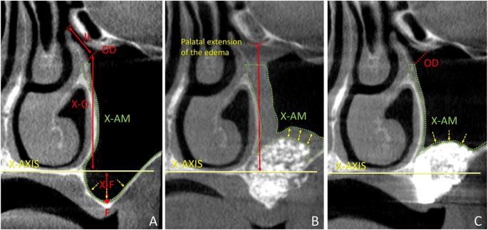Journal Sinusitis
