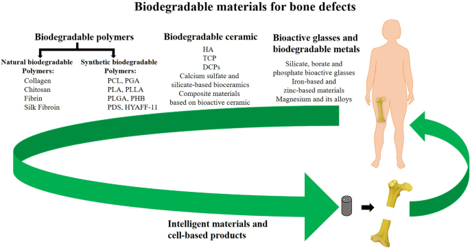 Biodegradable materials for bone defect repair | Military Medical 
